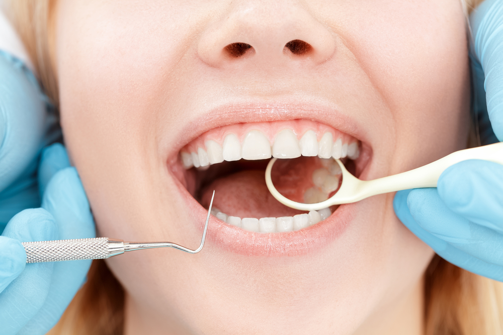 Importance of Regular Dental Checkups